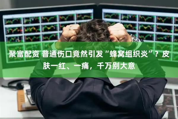 聚富配资 普通伤口竟然引发“蜂窝组织炎”？皮肤一红、一痛，千万别大意